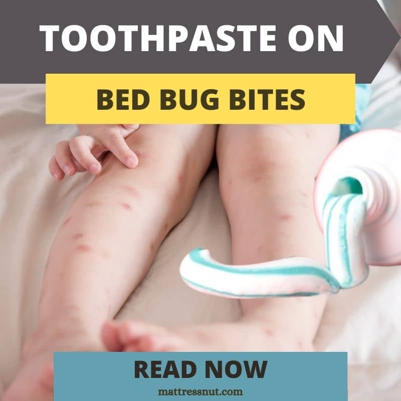 Toothpaste on Bed Bug Bites