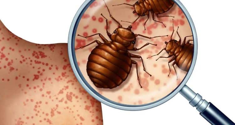 Understanding Bed Bug Bites